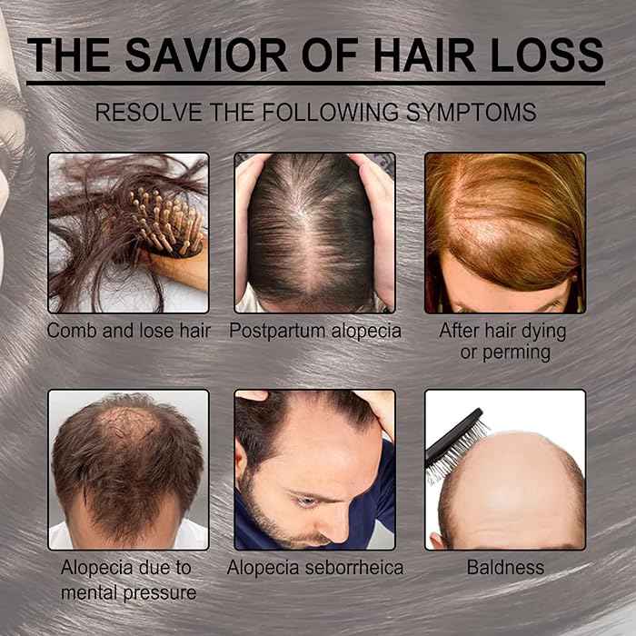 Rosemary Hair Growth Essential Oil Prevent Hair Loss Nourish Scalp Strengthen Hair