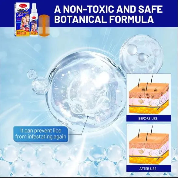 Lice Repellent Spray