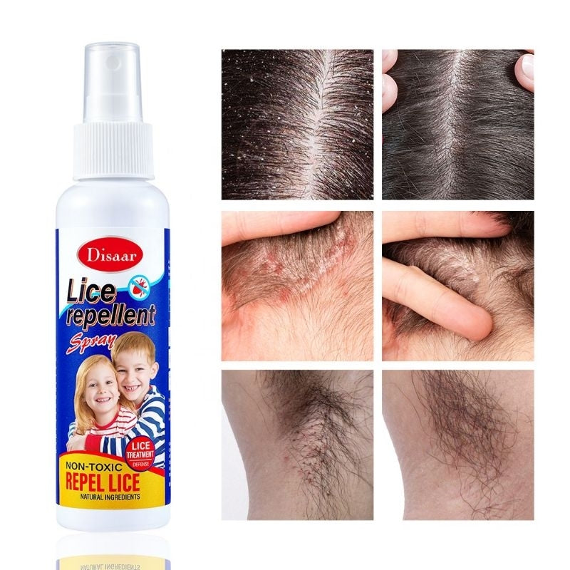 Lice Repellent Spray