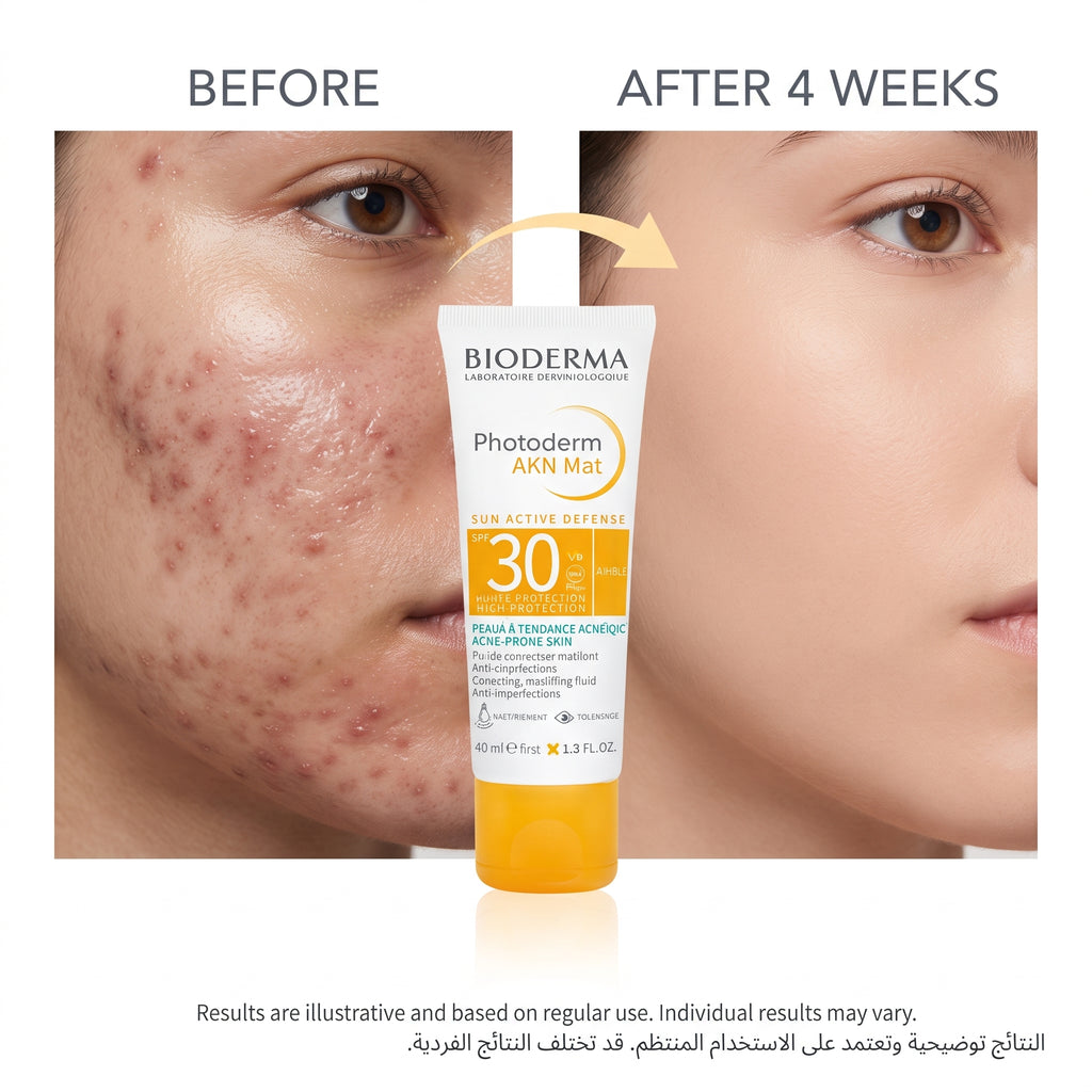 Bioderma Photoderm AKN Mat SPF 30