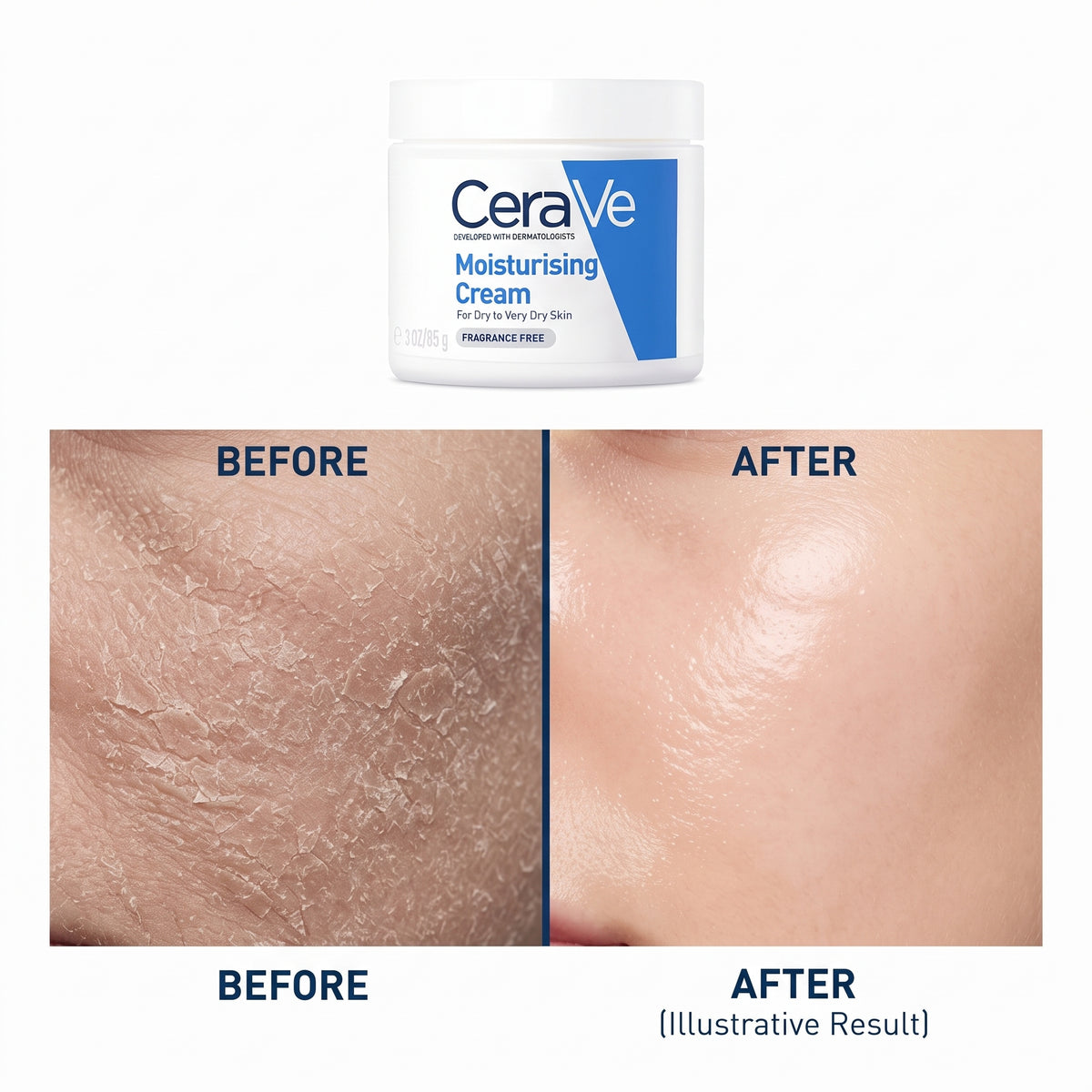 CeraVe Eye Repair Cream – For Dark Circles, Puffiness & Fine Lines