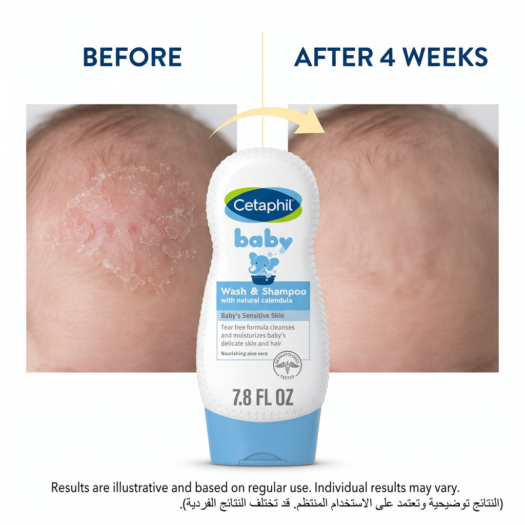 Cetaphil Baby Wash & Shampoo 230ml – Tear-Free 2-in-1 with Calendula