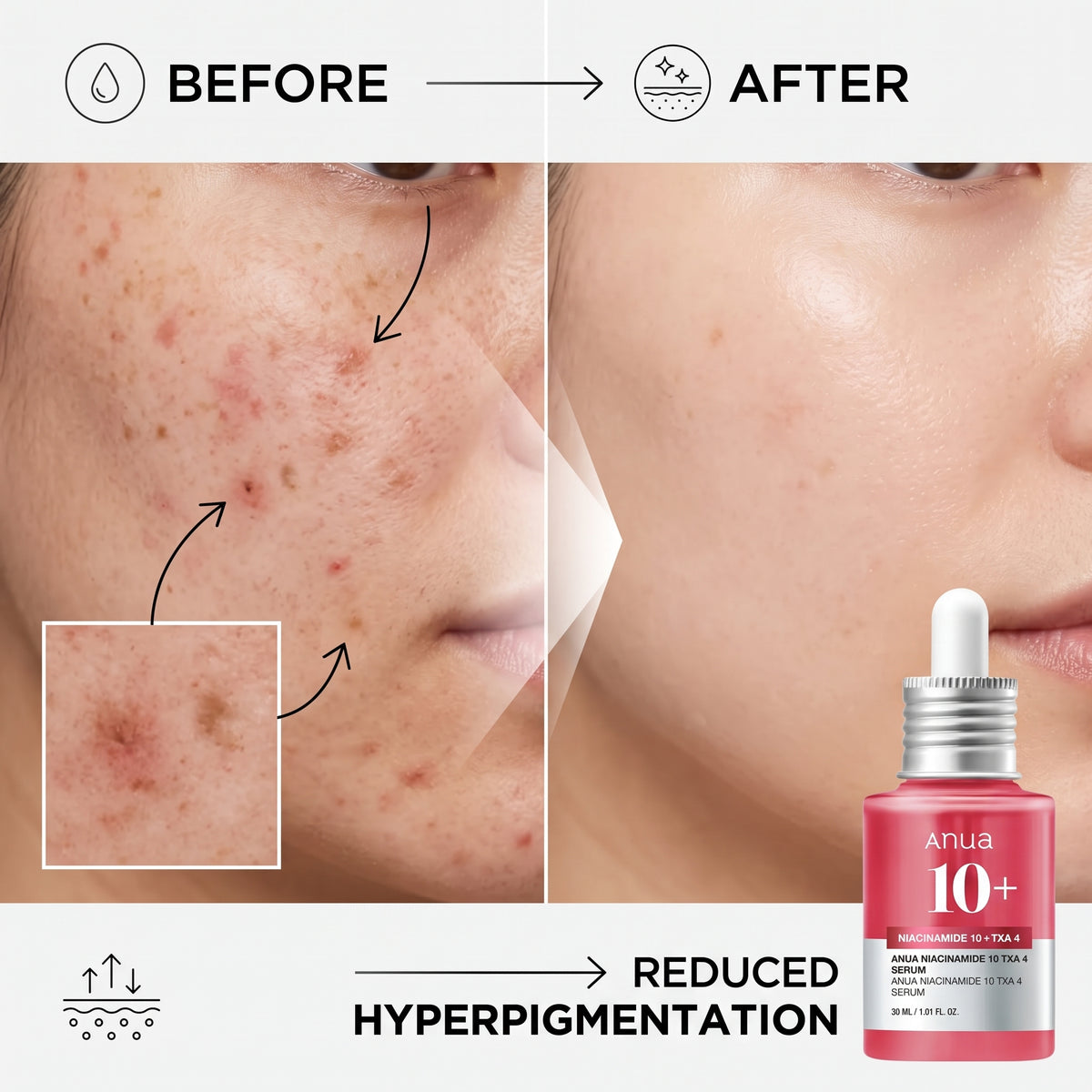 Anua Dark-Spot Duo — ثنائي التصبغات (Serum + SPF50+ Sun Cream)