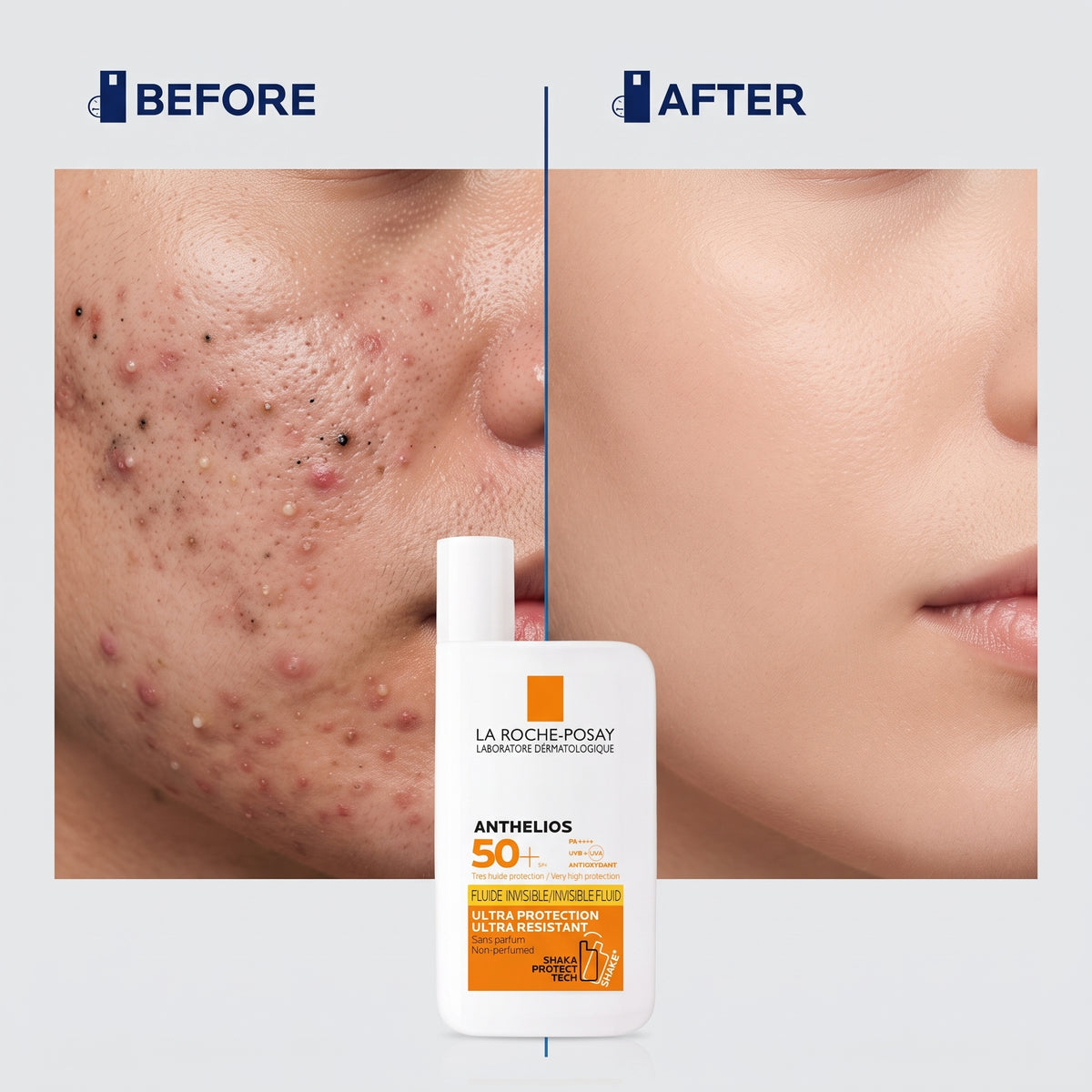 La Roche-Posay Anthelios Face Sunscreen 50ml – Broad Spectrum UVA/UVB, Fragrance-Free