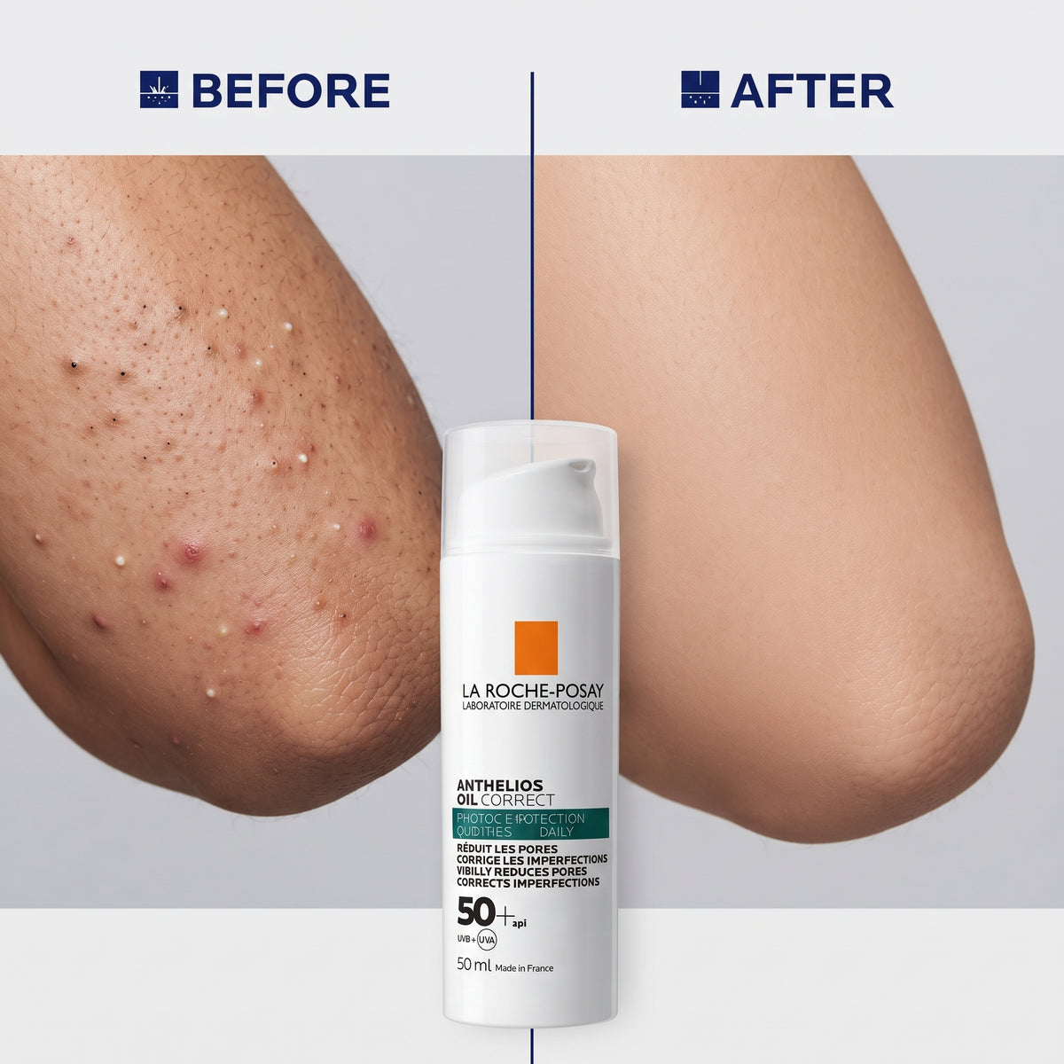 La Roche-Posay Anthelios Oil Correct SPF 50+ 50ml – Matte Anti-Blemish Sunscreen for Oily Skin