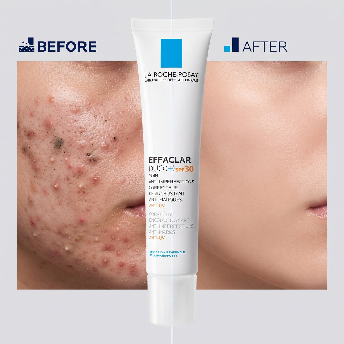 La Roche-Posay Effaclar Duo+ SPF 30 40ml – Anti-Blemish Moisturiser