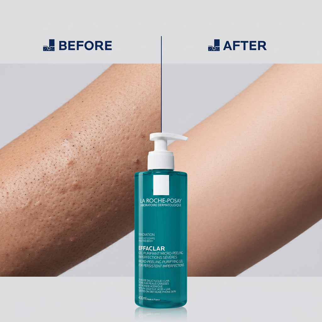 La Roche-Posay Effaclar Micro-Peeling Purifying Gel 400ml – Salicylic Acid Face Wash for Blackheads