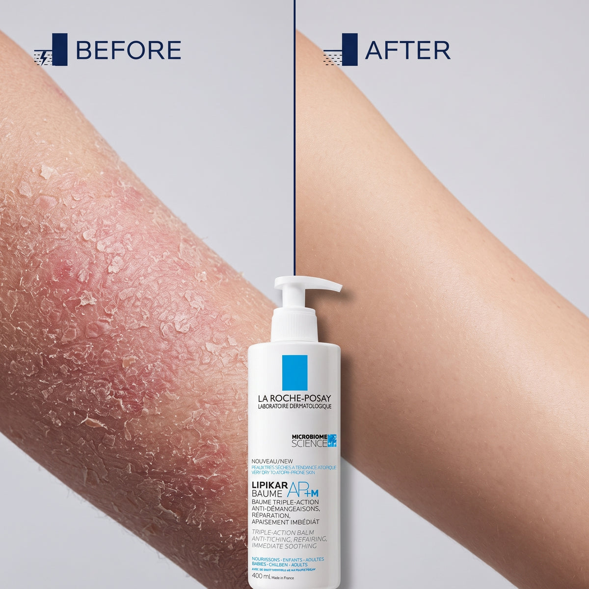 La Roche-Posay Lipikar Baume AP+M – 48h Body Balm for Dry, Itchy, Eczema-Prone Skin
