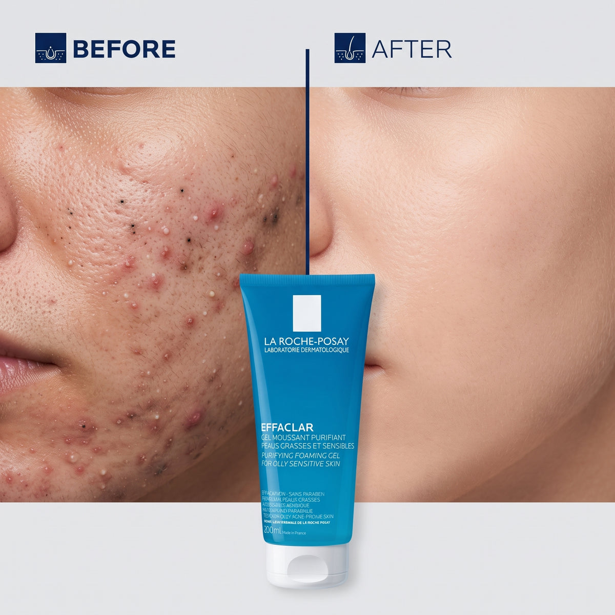 La Roche-Posay Toleriane Foaming Cleanser 125ml – Soap-Free Face Wash for Sensitive Skin