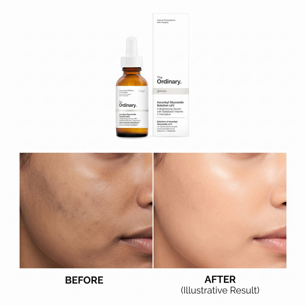 The Ordinary Ascorbyl Tetraisopalmitate 20% in Vitamin F 30ml – Vitamin C Oil Serum