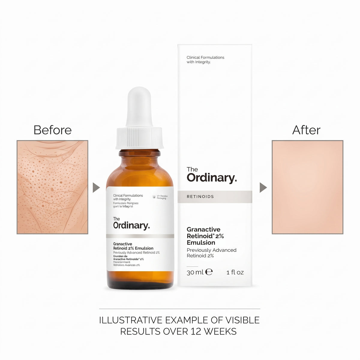The Ordinary Granactive Retinoid 2% Emulsion packaging