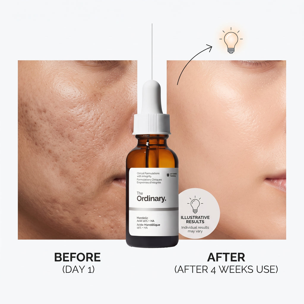 The Ordinary Mandelic Acid 10% + HA benefits