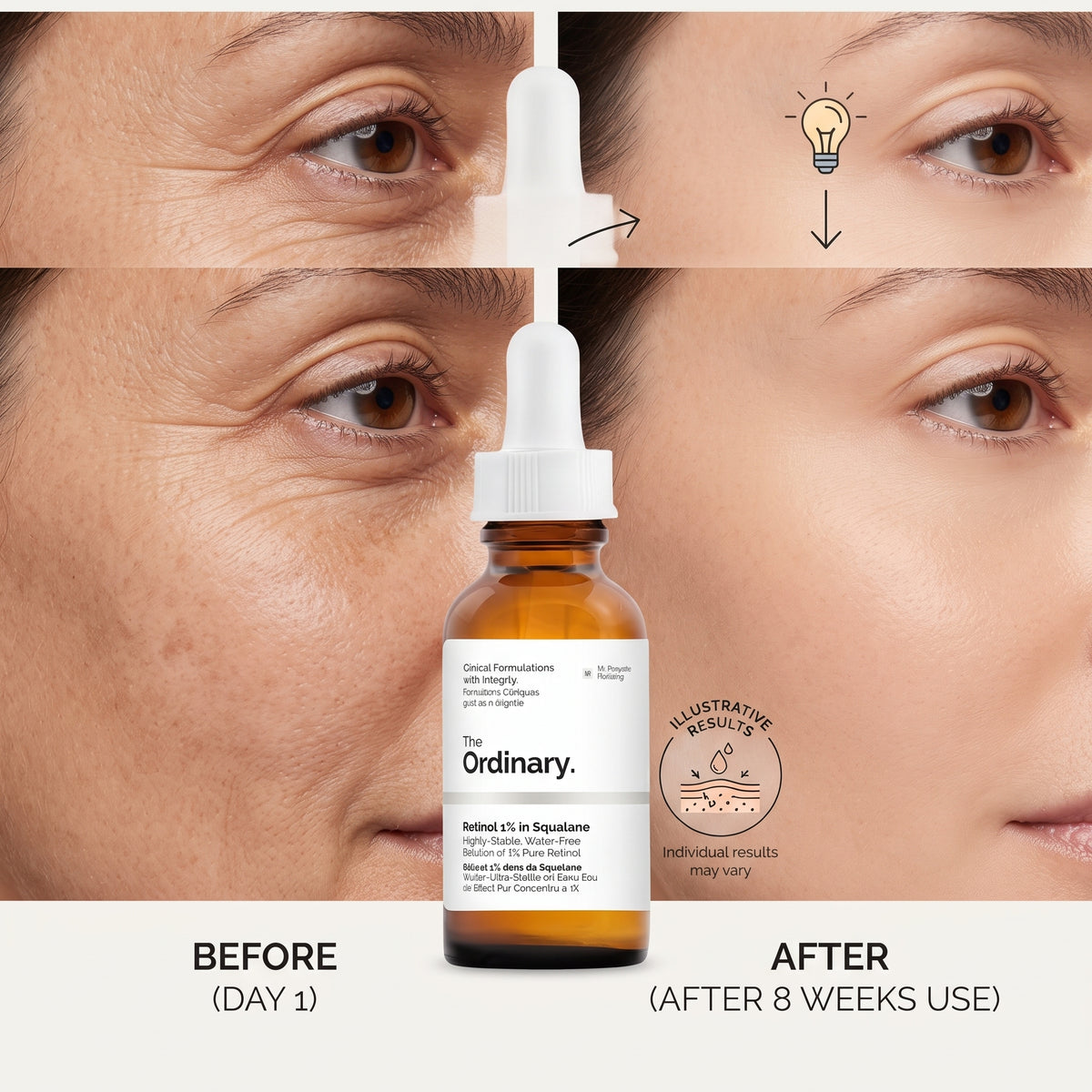 The Ordinary Retinol 1% in Squalane 30ml – High-Strength Retinol for Wrinkles & Stubborn Marks