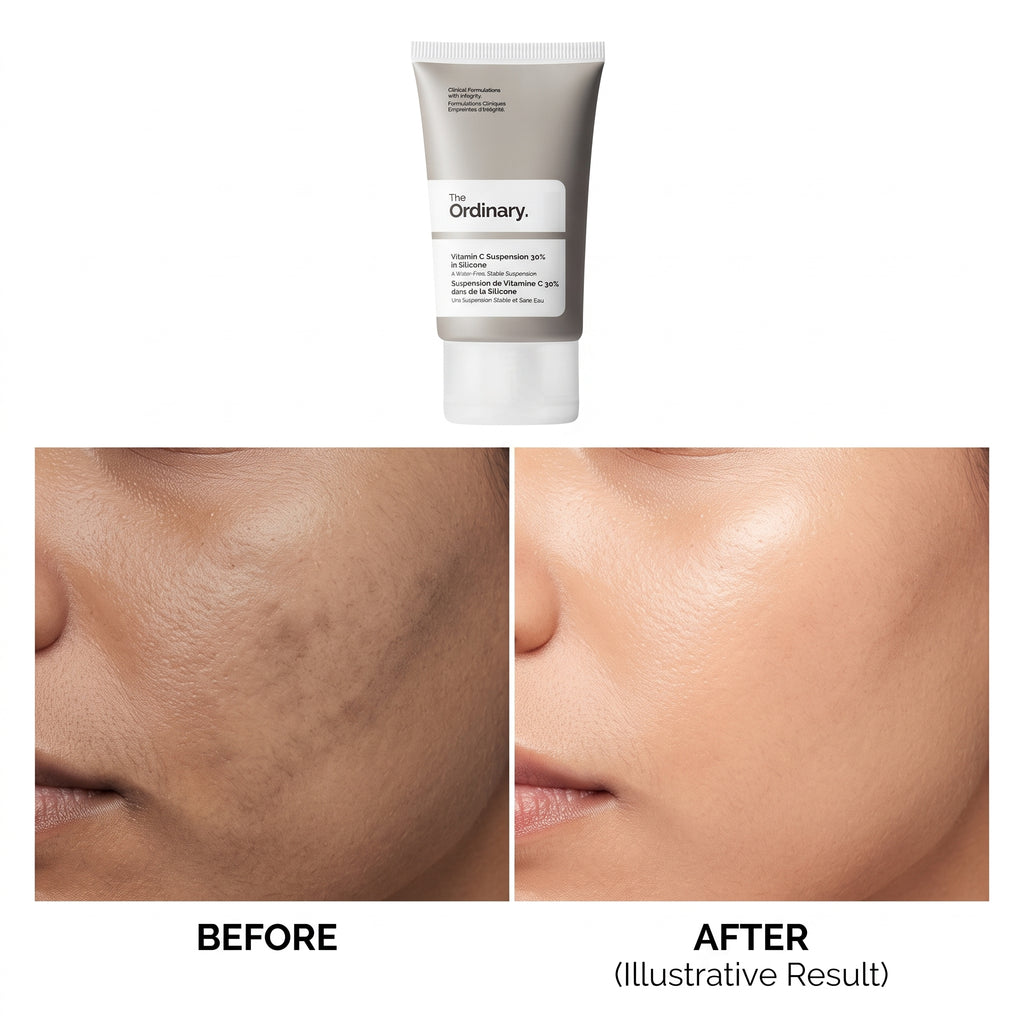 The Ordinary Vitamin C Suspension 30% in Silicone 30ml – Pure Vitamin C Brightening Treatment